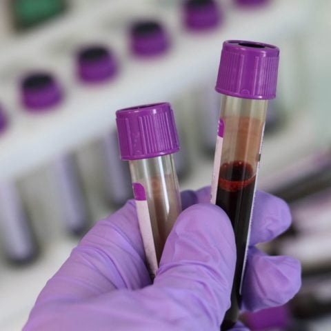 Laboratory & Diagnostics